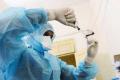 Telangana remains on high alert for swine flu - Sakshi Post