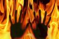 One more girl burnt alive in Hyderabad - Sakshi Post