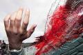 3 killed in auto-lorry collision in Andhra Pradesh - Sakshi Post