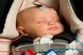 Hearing test may identify infants with autism risk - Sakshi Post