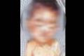 The child succumbed to injuries at Gandhi Hospital - Sakshi Post