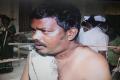 Suresh at Kakinada Government Hospital with the iron rod in his neck. - Sakshi Post