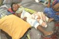 The child whose leg was broken during treatment at govt hospital - Sakshi Post