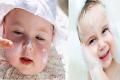 6 Ways To Manage Dry And Itchy Skin In Babies - Sakshi Post