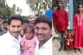 AP Govt Sanctions Rs1 Crore For Girl's Rare Genetic Disorder Treatment - Sakshi Post